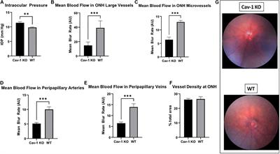 Loss of Caveolin-1 Impairs Light Flicker-Induced Neurovascular Coupling at the Optic Nerve Head